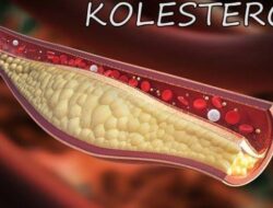 Ini Dia, Cara Menurunkan Kolestrol Tinggi Secara Alami