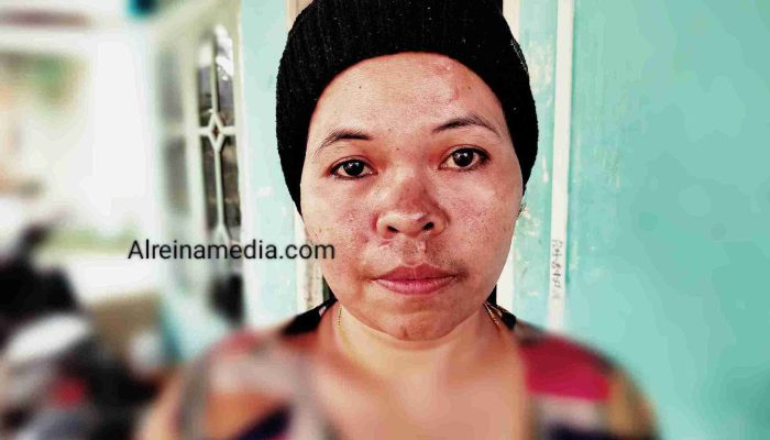 Korban ke 4 Bersaksi di Balik Tragis Tabrakan Maut di Kijang