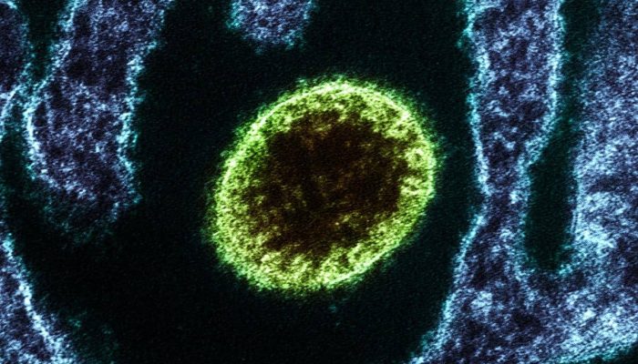 Nipah 72 Jam: Pertarungan Awal Pasien